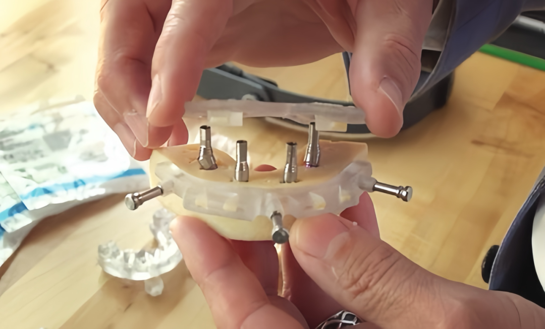Stratasys J5 DentaJet精準制作牙科手術(shù)部件